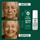 Spray Removedor 577 - Elimine Manchas Indesejáveis de Sol, Idade e Melasma. Com 50% de DESCONTO + FRETE GRÁTIS!