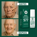 Spray Removedor 577 - Elimine Manchas Indesejáveis de Sol, Idade e Melasma. Com 50% de DESCONTO + FRETE GRÁTIS!