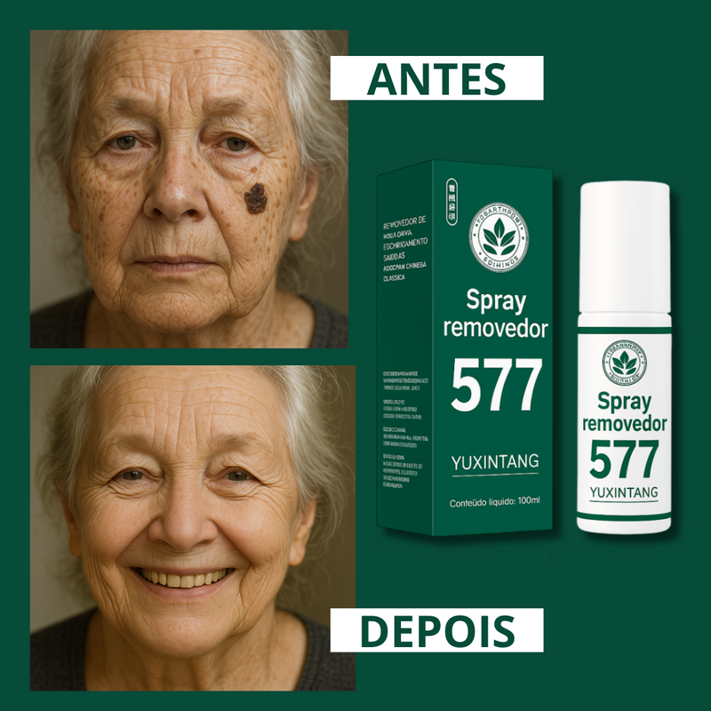 Spray Removedor 577 - Elimine Manchas Indesejáveis de Sol, Idade e Melasma. Com 50% de DESCONTO + FRETE GRÁTIS!