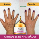 Máscara Clareadora e Anti-idade para as Mãos - RtopR - Clareia, Hidrata e Rejuvenesce. 50% DE DESCONTO + FRETE GRÁTIS